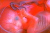 внутриутробное развитие плода. календарь беременности 13 неделя