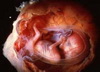 внутриутробное развитие плода. календарь беременности 16 неделя