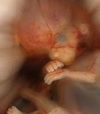 внутриутробное развитие плода. календарь беременности 8 неделя