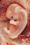 внутриутробное развитие плода. календарь беременности 9 неделя